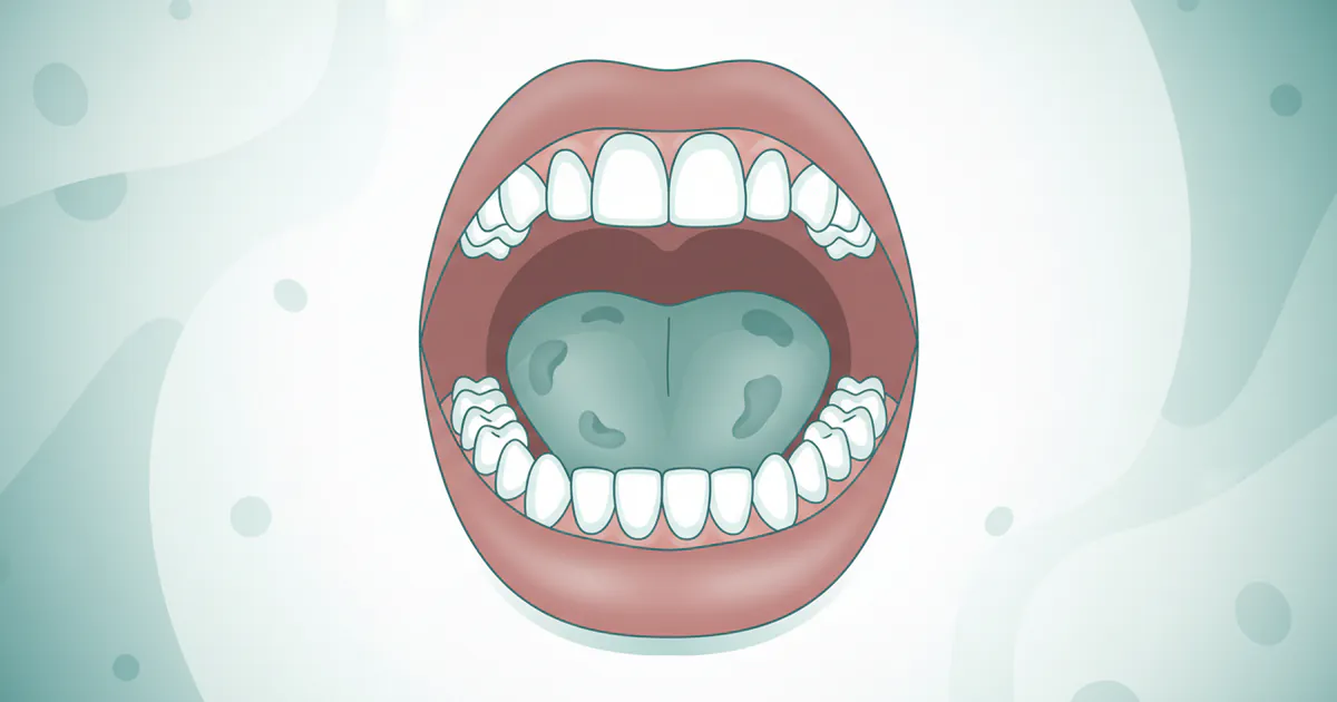 Mouth Cancer Photos: Complete Guide